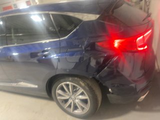 2024 Acura RDX Technology Package - Primary Damage Right Image